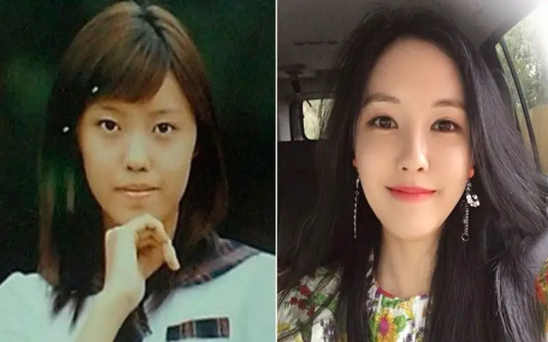 T-Ara’s Hyomin: plastic surgery