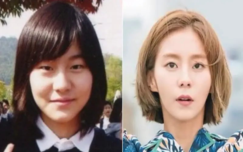 UEE: Korean Celebrities with Plastic Surgery